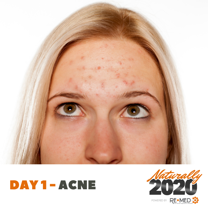 young girl with acne
